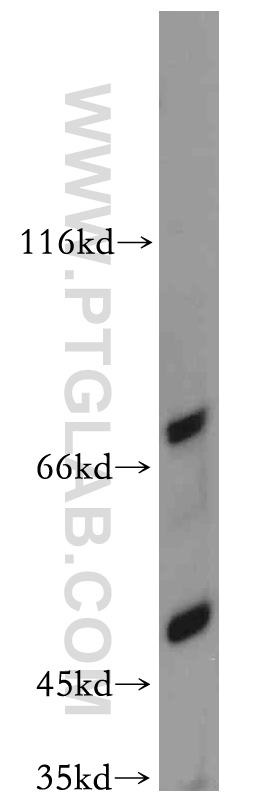 20443-1-AP;mouse colon tissue