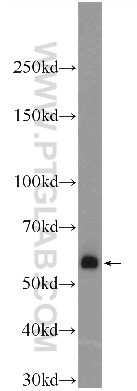 12702-1-AP;human skeletal muscle tissue