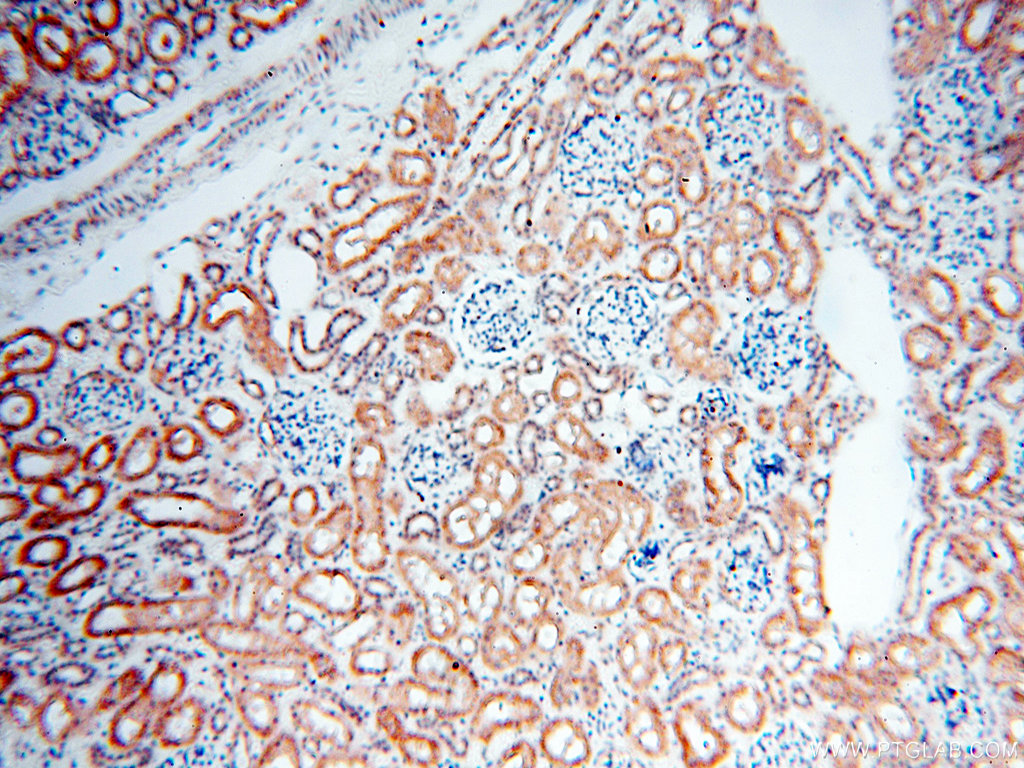 17974-1-AP;H-kidney