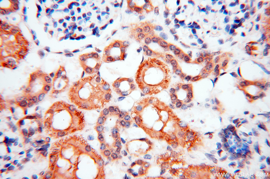 17974-1-AP;H-kidney