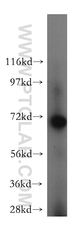 15391-1-AP;MCF7 cells