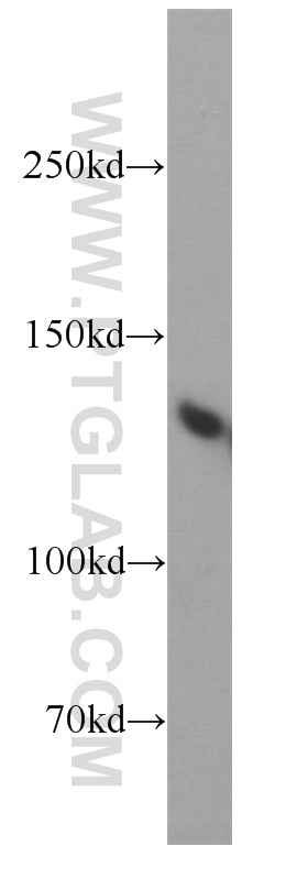 10476-1-AP;HeLa cells