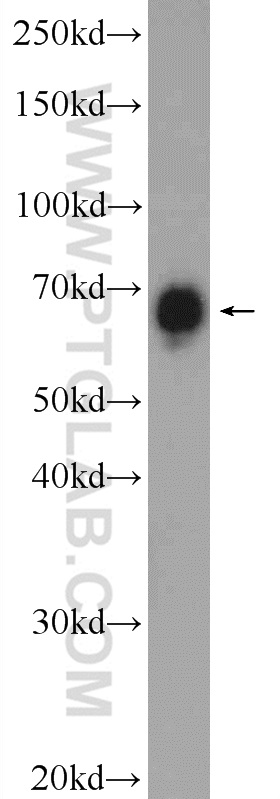 24785-1-AP;HeLa cells