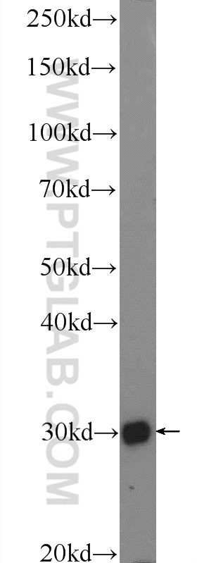 16096-1-AP;MCF-7 cells