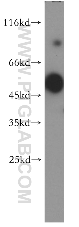 19078-1-AP;human brain tissue