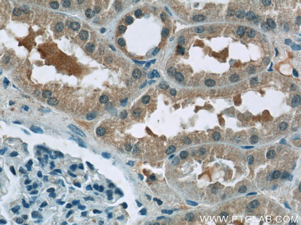 24733-1-AP;human kidney tissue