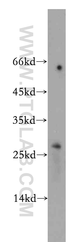 20514-1-AP;HeLa cell