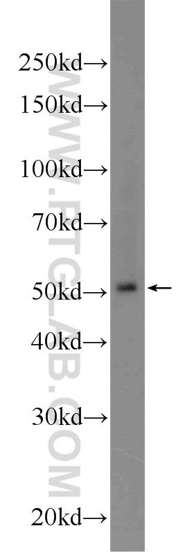 24959-1-AP;MCF-7 cells