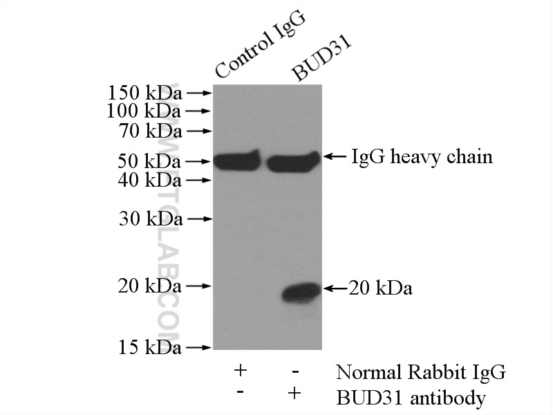 11798-1-AP;mouse brain tissue