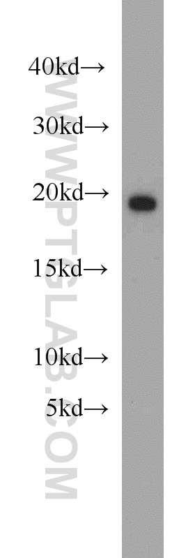 11798-1-AP;mouse brain tissue