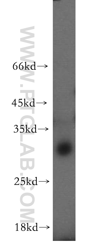 20195-1-AP;mouse lung tissue