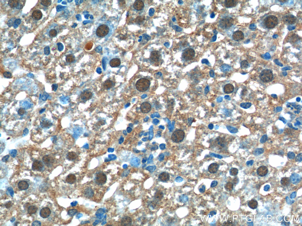 23251-1-AP;mouse liver tissue