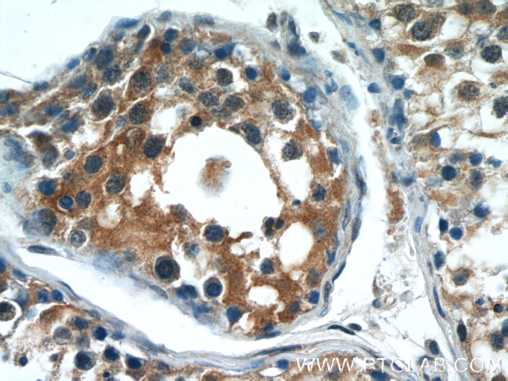 24722-1-AP;human testis tissue