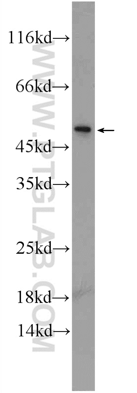 24722-1-AP;PC-3 cells