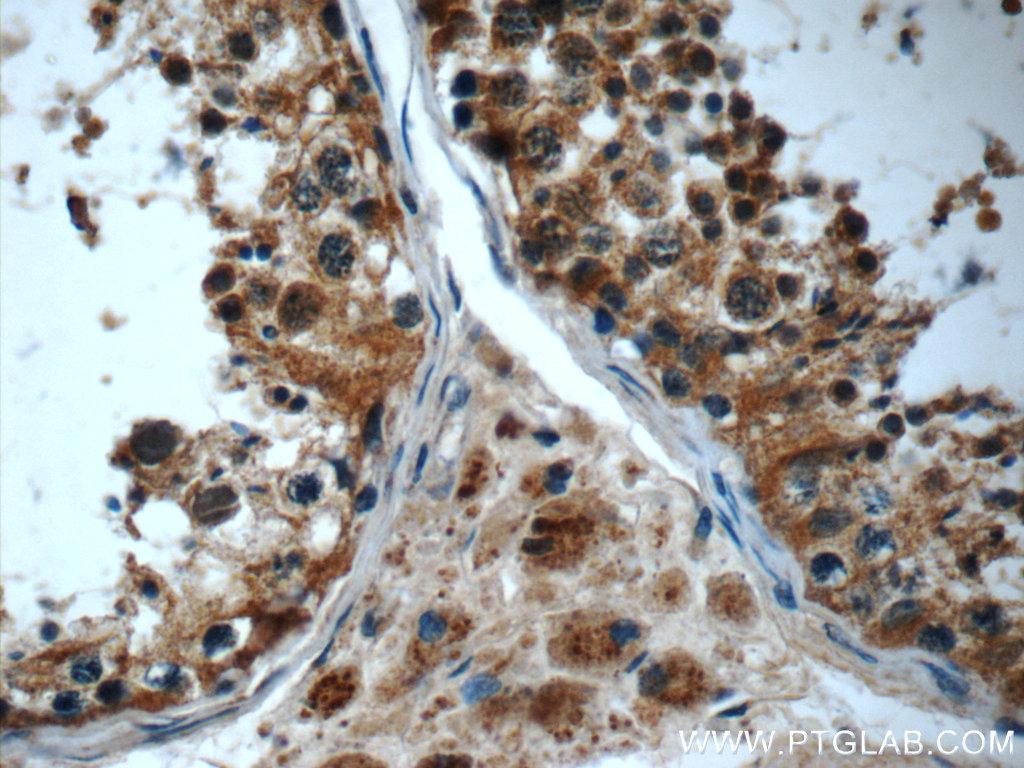 24338-1-AP;human testis tissue