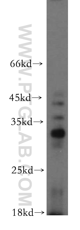 20115-1-AP;PC-3 cell