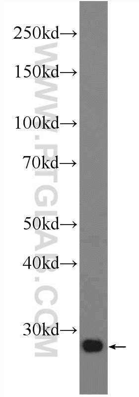 24795-1-AP;human placenta tissue