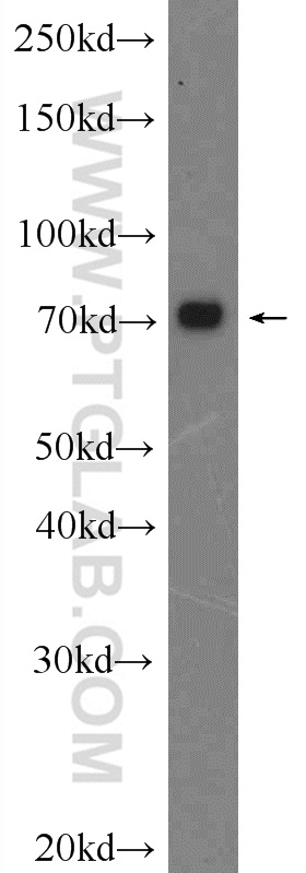 24384-1-AP;HeLa cells