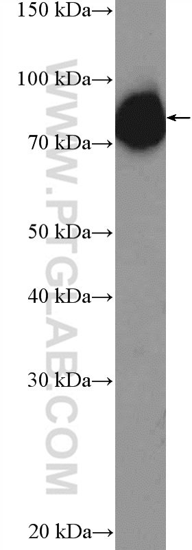 26338-1-AP;MCF-7 cells