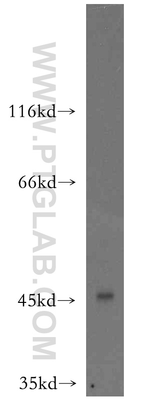 14023-1-AP;BxPC-3 cells