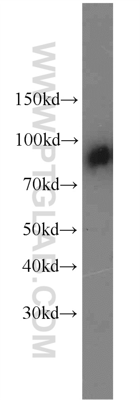 14554-1-AP;human blood tissue