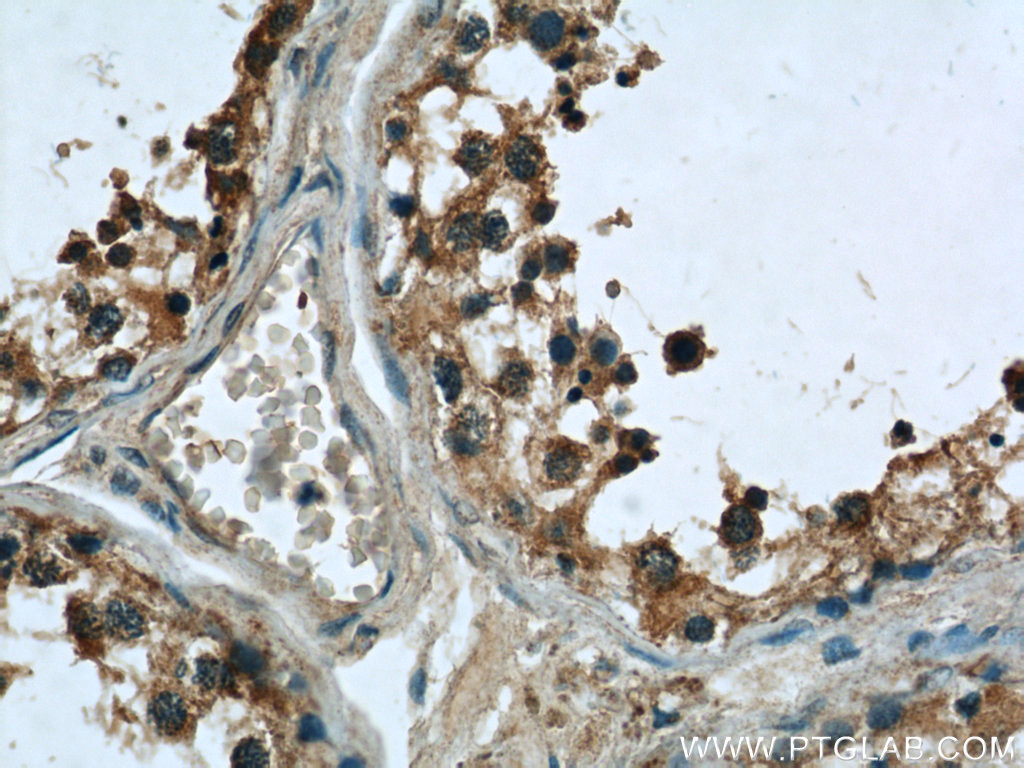 24429-1-AP;human testis tissue