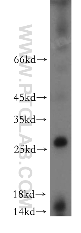 21456-1-AP;mouse spleen tissue