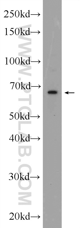 24870-1-AP;mouse lung tissue