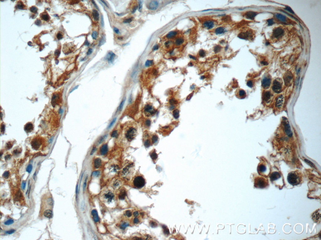 24183-1-AP;human testis tissue