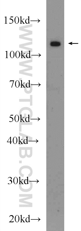 24183-1-AP;PC-3 cells