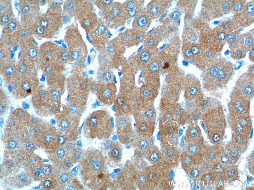 21337-1-AP;human liver tissue