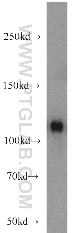 21337-1-AP;human blood tissue