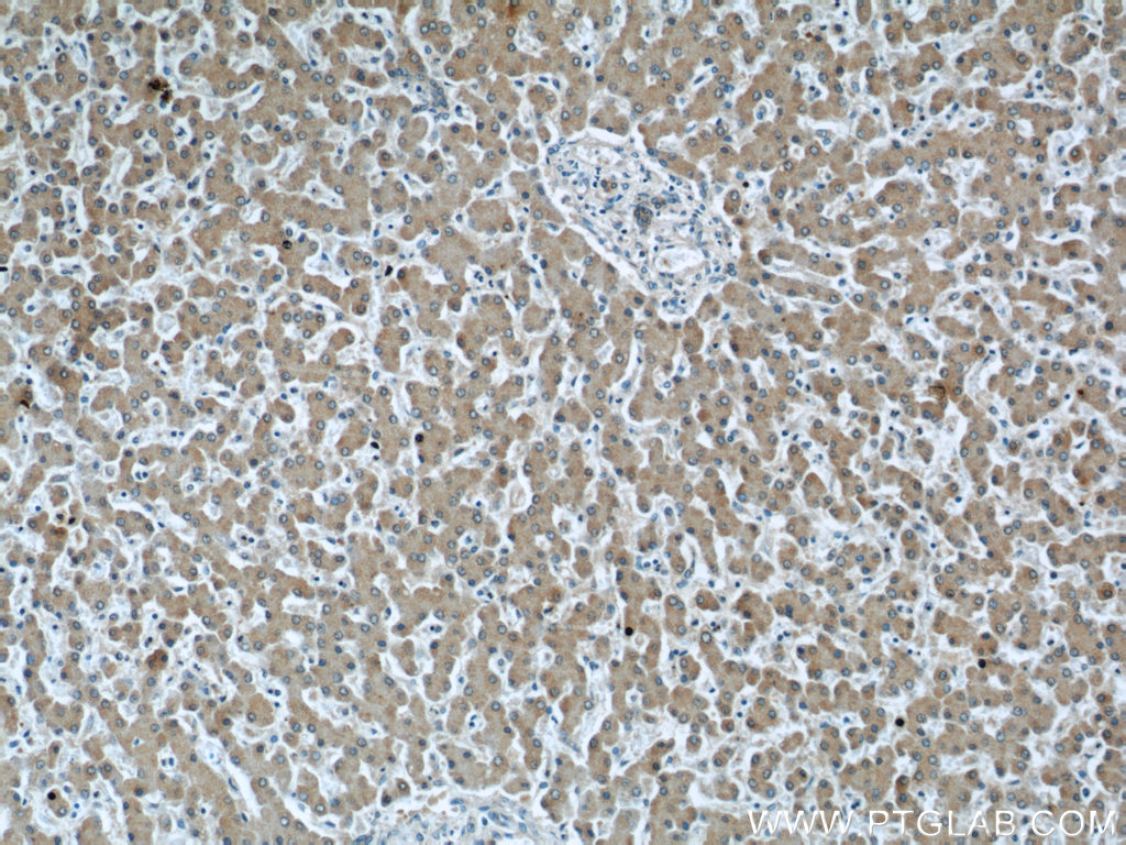 c3-c3b-c3c-antibody-66157-1-ig-proteintech