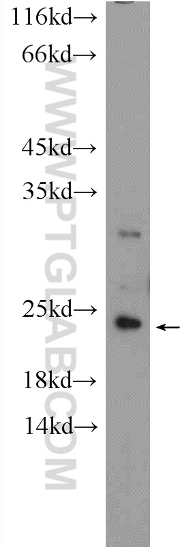 26036-1-AP;mouse liver tissue