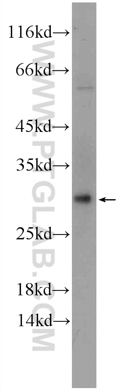 25362-1-AP;mouse heart tissue