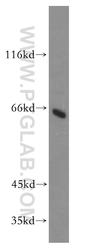 18991-1-AP;HepG2 cell