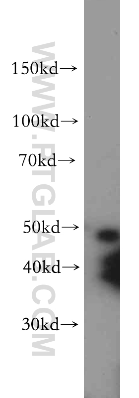 20444-1-AP;HEK-293 cell