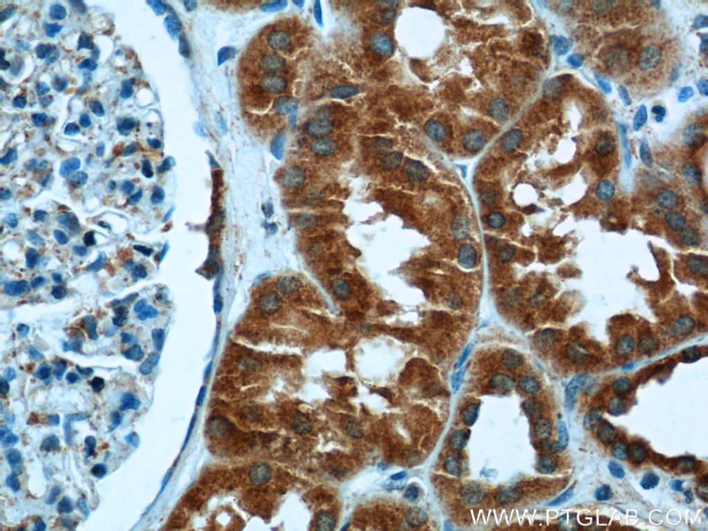 25249-1-AP;human kidney tissue