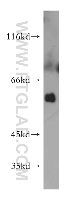 21589-1-AP;mouse skeletal muscle tissue