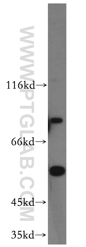 20475-1-AP;HeLa cell