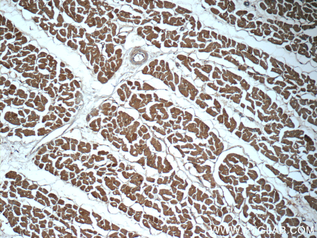 25630-1-AP;human heart tissue