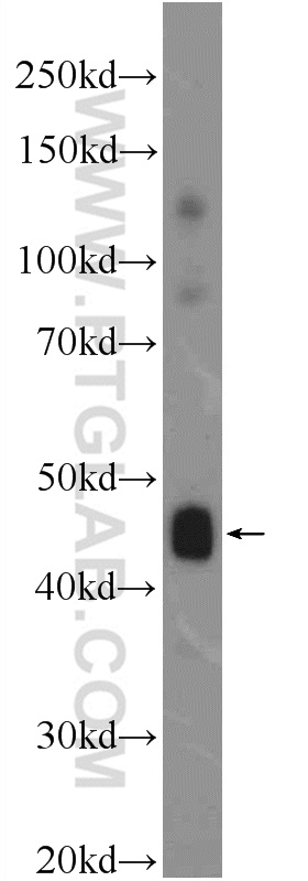 25630-1-AP;mouse skeletal muscle tissue