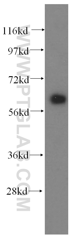 15528-1-AP;human skeletal muscle tissue