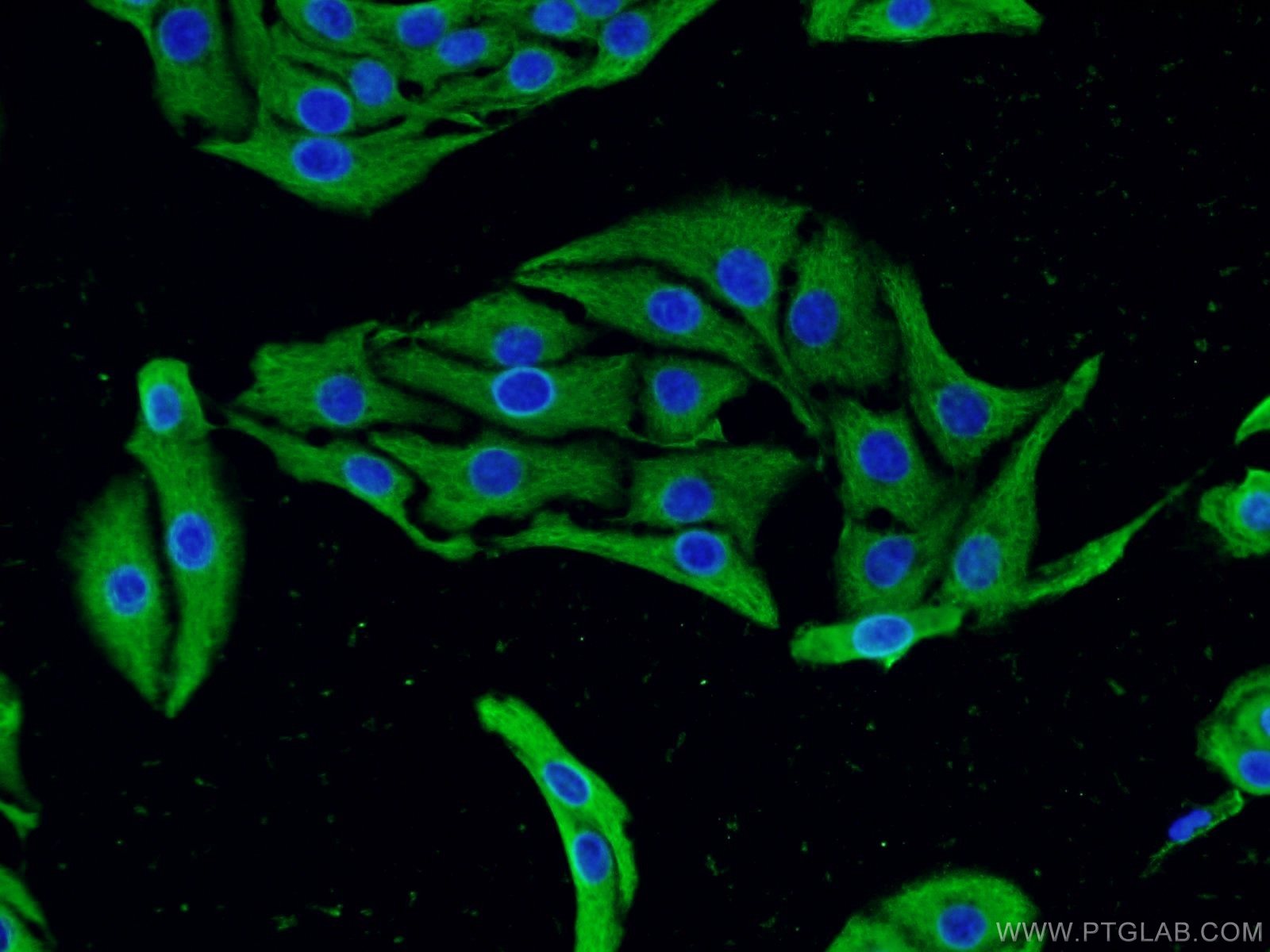 22276-1-AP;SH-SY5Y cells