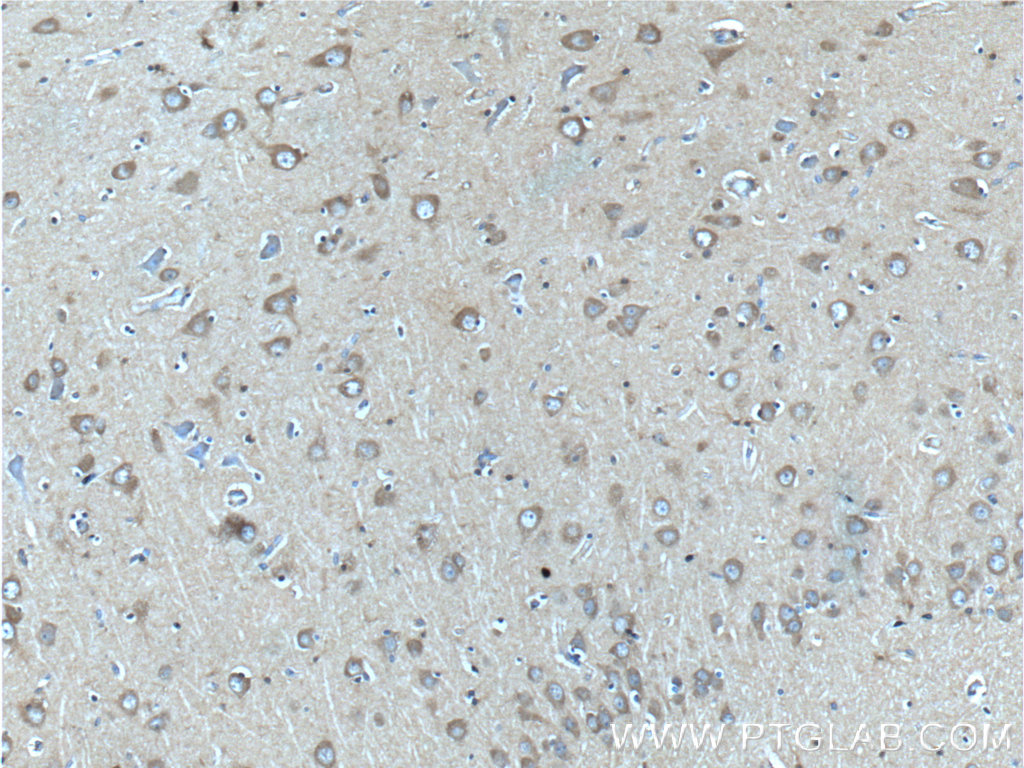 22276-1-AP;human brain tissue