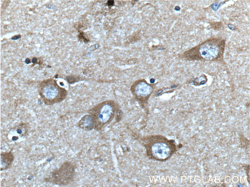 22276-1-AP;human brain tissue