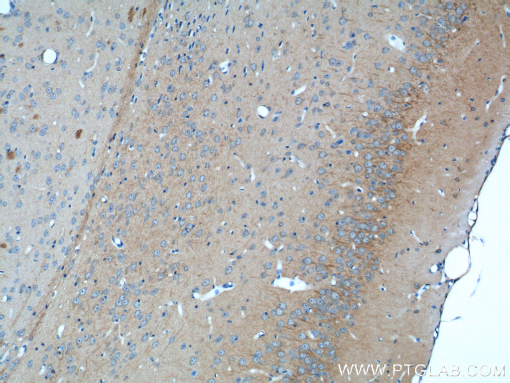 20969-1-AP;mouse brain tissue