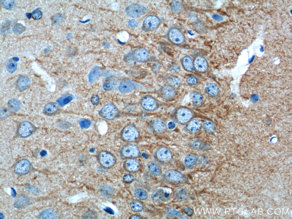 20969-1-AP;mouse brain tissue