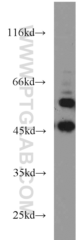 17804-1-AP;HEK-293 cells