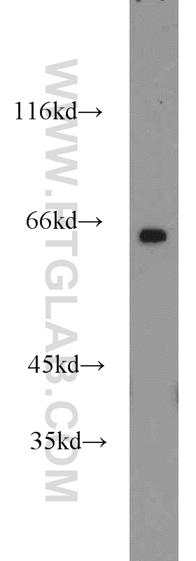 14788-1-AP;mouse brain tissue